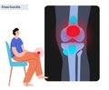 Bursitis inflammation concept Royalty Free Stock Photo