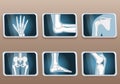 Knee, Elbow, wrist, hip, shoulder joints and Articulations of foot. Set icons