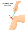 The knee-jerk reflex