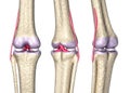 Knee joint anatomy