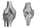 Knee joint front view (left) and sectional view (right).