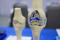 knee joint model after replacement surgery