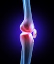 Knee Joint Pain