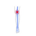 Knee joint pain