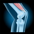 Knee joint with Quadriceps