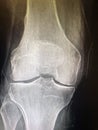 Knee joint x-ray image