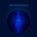 Knee joint x-ray medical template for orthopedics clinics