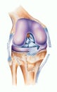 Knee - Ligament Tears Royalty Free Stock Photo