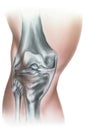 Knee - Meniscus Damage and Hypertrophy