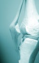 Knee meniscus medical model
