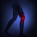 Knee Pain, Health problems.