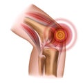 Knee pain. Injury to the leg, patella, knee joint.