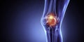 Understanding Knee Pain During Running XRay Diagnosis Treatment and Recovery Strategies for Runners Royalty Free Stock Photo