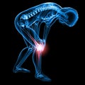 Knee pain X-ray