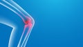 Knee painful. x-ray. Joint pains. 3d Vector illustration Royalty Free Stock Photo