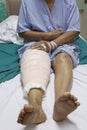 Knee replacement incision Royalty Free Stock Photo