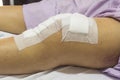 Knee surgery in hospital Royalty Free Stock Photo