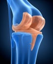 Knee and titanium hinge joint. X-ray view