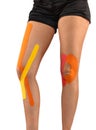 Knee treated with tape therapy Royalty Free Stock Photo