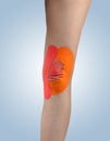 Knee treated with tape therapy Royalty Free Stock Photo