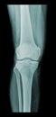 Knee x-ray