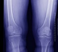 Knee x-ray Royalty Free Stock Photo