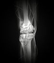 Knee X-ray Arteries, Bones Royalty Free Stock Photo