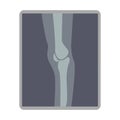 Knee x ray image semi flat color vector object