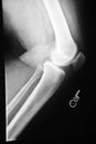 Knee Xray Royalty Free Stock Photo