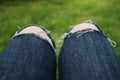 Knees with fuzzi jeans over Green Grass Backyard. Relax Holliday concept. Summer Time.