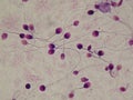 Human spermatozoid, frotis semen sample