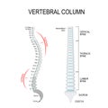 Kyphosis & Lordosis. Vertebral column Royalty Free Stock Photo