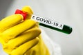 Lab scientist or medical technologist holding test tube with Coronavirus COVID-19 toxic green liquid