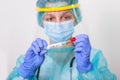 Lab technician holding swab collection kit,Coronavirus COVID-19 specimen collecting equipment,DNA nasal and oral swabbing for PCR