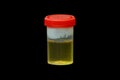 Laboratory analysis of urine for pregnant and diabetic patients. Royalty Free Stock Photo