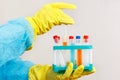 Laboratory assistant hands in rubber gloves doing chemical experiments in laboratory