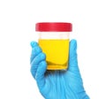 Laboratory assistant holding container with urine sample for analysis on white background