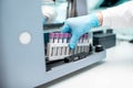 Putting test tubes into the analyzer machine Royalty Free Stock Photo