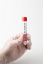 Laboratory - COVID-19 Pandemic COVID-19 test tube results from Corona virus patients. Royalty Free Stock Photo