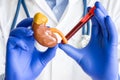 Laboratory medical diagnostics, tests for kidneys, adrenal hormones concept photo. Doctor or laboratory technician holds in one ha
