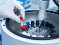 Laboratory Technician Handling Blood Samples in Centrifuge Royalty Free Stock Photo
