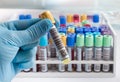 Laboratory technician holding a blood tube test