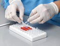 Laboratory Technician Preparing Medical Samples with Test Tubes and Pipette Royalty Free Stock Photo