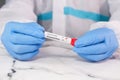 Laboratory technician hand holding blood test tube Royalty Free Stock Photo