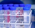 Laboratory test tubes in rack. Concept of science, laboratory and study of diseases Royalty Free Stock Photo