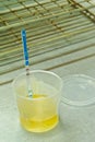 Laboratory urine