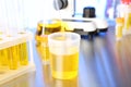 Laboratory ware with samples for urine analysis Royalty Free Stock Photo