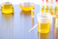 Laboratory ware with samples for urine analysis. Space for text Royalty Free Stock Photo