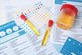 Laboratory ware with urine samples for analysis on test form Royalty Free Stock Photo