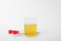 Laboratory ware with urine samples for analysis on white Royalty Free Stock Photo